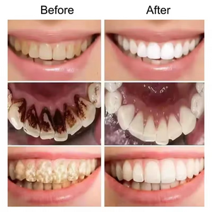 Real Glow™ Purple Whitening Toothpaste
