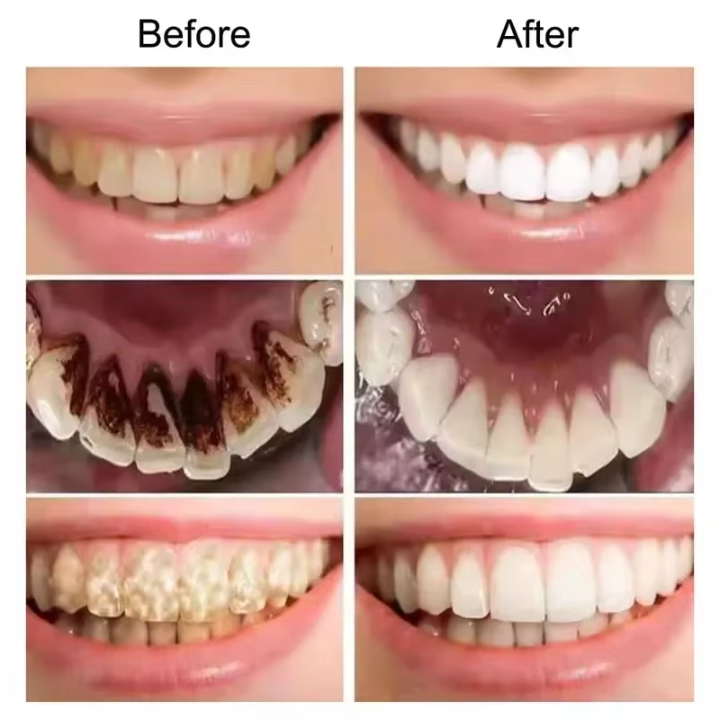 Real Glow™ Purple Whitening Toothpaste